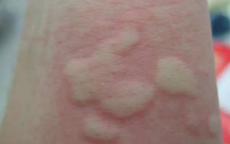 An Yen Co Bi Di Ung 1