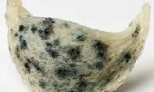 To Yen bi moc 1 1